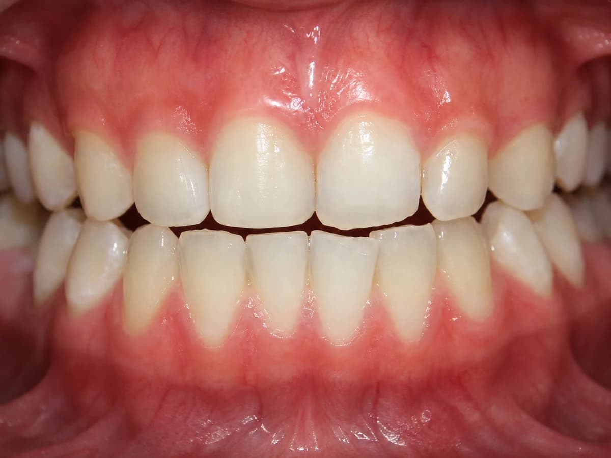 Restorative visual simulation example - After